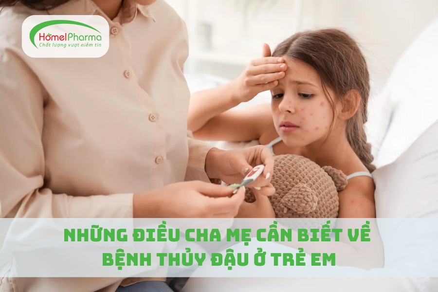 Những Điều Cha Mẹ Cần Biết Về Bệnh Thủy Đậu Ở Trẻ Em