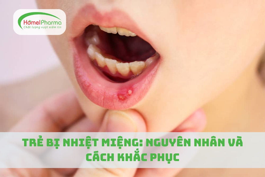 Trẻ Bị Nhiệt Miệng: Nguyên Nhân Và Cách Khắc Phục