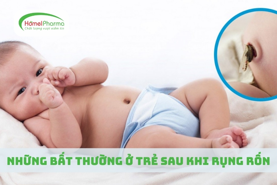 Những Bất Thường Ở Trẻ Sau Khi Rụng Rốn