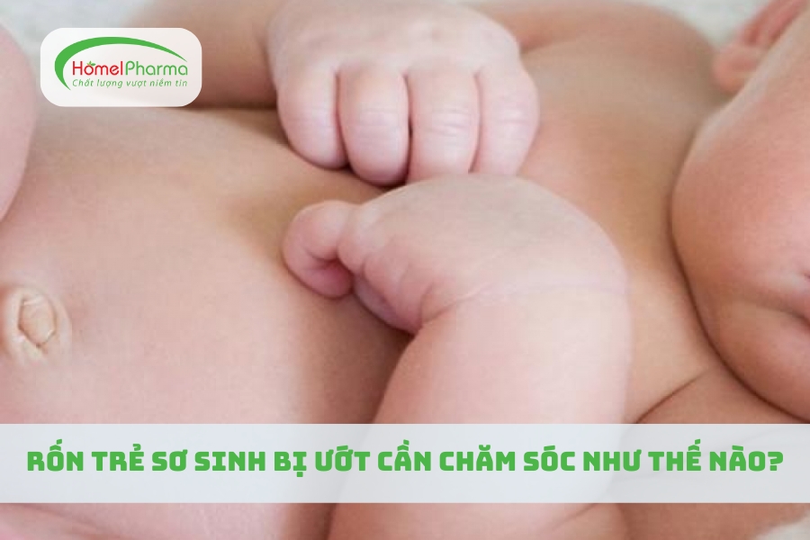 Rốn Trẻ Sơ Sinh Bị Ướt Cần Chăm Sóc Như Thế Nào?